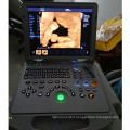 portable ultrasound scanner handheld ultrasound machine dopplers